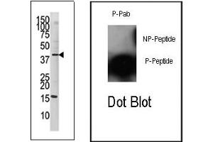 Image no. 2 for anti-Jun Proto-Oncogene (JUN) (pSer63) antibody (ABIN358110) (C-JUN 抗体  (pSer63))