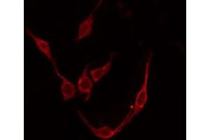 ABIN6276059 staining COLO205 by IF/ICC. (TACR3 抗体  (C-Term))