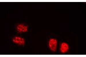 Immunofluorescent analysis of TCOF1 staining in HEK293T cells. (TCOF1 抗体  (N-Term))