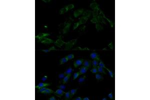 Immunofluorescence (IF) image for anti-ATPase, H+ Transporting, Lysosomal 16kDa, V0 Subunit C (ATP6V0C) (AA 1-100) antibody (ABIN7265760)