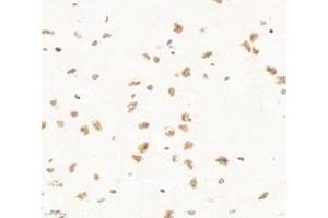 Immunohistochemistry analysis of paraffin-embedded rat brain using,PQBP1 (ABIN7075126) at dilution of 1: 6000