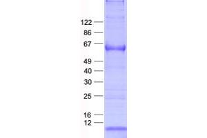 Western Blotting (WB) image for Melanoma Antigen Family C, 2 (MAGEC2) protein (His tag) (ABIN2725215)