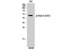 Western Blotting (WB) image for anti-Programmed Cell Death 4 (PDCD4) (pSer457) antibody (ABIN3182643) (PDCD4 抗体  (pSer457))