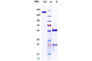 Anti-TNFSF2 / TNFa Reference Antibody (CDP571) on SDS-PAGE under reducing (R) condition.