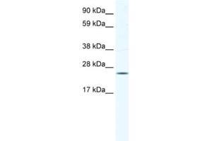 Western Blotting (WB) image for anti-Potassium Channel Tetramerisation Domain Containing 6 (KCTD6) antibody (ABIN2461578) (KCTD6 抗体)
