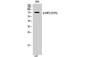 Western Blotting (WB) image for anti-ROP Interactive Partner 2 (RIP2) (pSer176) antibody (ABIN3182676) (RIP2 抗体  (pSer176))