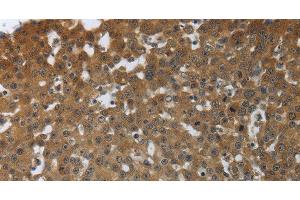 Immunohistochemistry (Paraffin-embedded Sections) (IHC (p)) image for anti-Protein Tyrosine Phosphatase, Receptor Type, M (PTPRM) antibody (ABIN7238327)