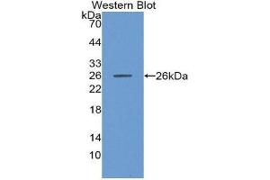 Western Blotting (WB) image for anti-Matrix Metallopeptidase 11 (Stromelysin 3) (MMP11) (AA 277-488) antibody (ABIN3201362) (MMP11 抗体  (AA 277-488))