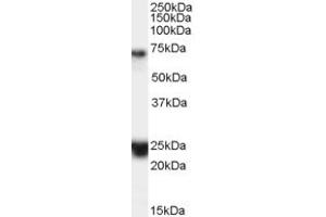 Western Blotting (WB) image for anti-Huntingtin Associated Protein 1 (HAP1) (Internal Region) antibody (ABIN2465804) (HAP1 抗体  (Internal Region))