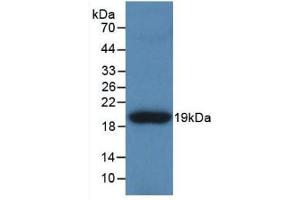 Detection of Recombinant TNC, Human using Polyclonal Antibody to Tenascin C (TNC) (TNC 抗体  (AA 49-181))