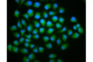 Immunofluorescence staining of Hela cells with ABIN7173520 at 1:166, counter-stained with DAPI. (C2orf60 抗体  (AA 1-152))