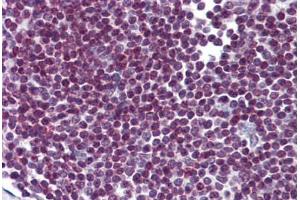 Human Spleen: Formalin-Fixed, Paraffin-Embedded (FFPE) (FOXO3 抗体  (AA 361-460))