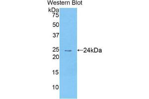 Western Blotting (WB) image for anti-Chemokine (C-C Motif) Ligand 25 (CCL25) (AA 24-150) antibody (ABIN1174416)