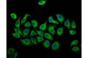 Immunofluorescence staining of A549 cells with ABIN7144528 at 1:166, counter-stained with DAPI. (ALOX12 抗体  (AA 508-658))