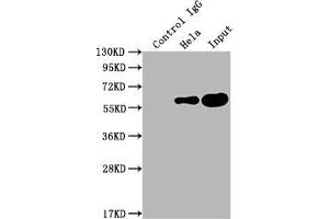 Immunoprecipitating PKM in Hela whole cell lysate Lane 1: Rabbit control IgG instead of ABIN7127769 in Hela whole cell lysate. (Recombinant PKM 抗体)