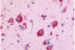 Anti-NEK7 antibody  ABIN1049091 IHC staining of human brain, neurons and glia. (NEK7 抗体  (Kinase Domain))