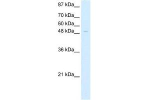Human HepG2; WB Suggested Anti-ZNF70 Antibody Titration: 5. (ZNF70 抗体  (C-Term))