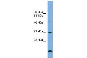 Western Blotting (WB) image for anti-B-Cell CLL/lymphoma 2 (BCL2) (Middle Region) antibody (ABIN2787860)