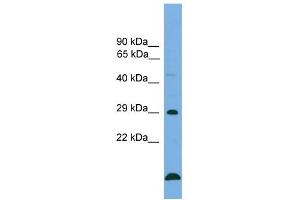WB Suggested Anti-BCL2 Antibody Titration: 0. (Bcl-2 抗体  (Middle Region))