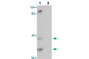 Western blot analysis of TMPRSS11A in mouse liver tissue with TMPRSS11A polyclonal antibody  at 1 ug/mL in (lane 1) the absence and (lane 2) the presence of blocking peptide. (TMPRSS11A 抗体  (C-Term))
