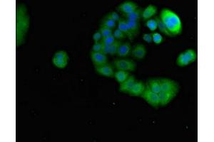 Immunofluorescent analysis of PC-3 cells using ABIN7164763 at dilution of 1:100 and Alexa Fluor 488-congugated AffiniPure Goat Anti-Rabbit IgG(H+L) (PRR11 抗体  (AA 1-360))
