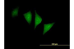 Immunofluorescence of purified MaxPab antibody to PFTK1 on HeLa cell. (CDK14 抗体  (AA 1-451))