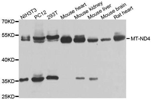 Mitochondrially Encoded NADH Dehydrogenase 4 (MT-ND4) (AA 350-450) 抗体