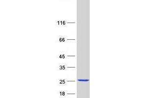 Ubiquitin-Conjugating Enzyme E2D 3 (UBE2D3) (Transcript Variant 9) protein (Myc-DYKDDDDK Tag)