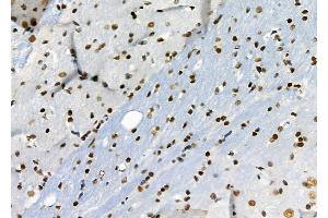 ABIN6264661 and ABIN6276692 at 1/100 staining Rat brain tissue by IHC-P. (Retinoblastoma Binding Protein 4 抗体  (C-Term))