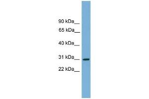 WB Suggested Anti-HLA-DQA2 Antibody Titration:  0. (HLA-DQA2 抗体  (Middle Region))