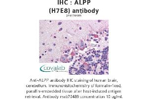 Image no. 1 for anti-Placental Alkaline Phosphatase (ALPP) antibody (ABIN1723355) (PLAP 抗体)