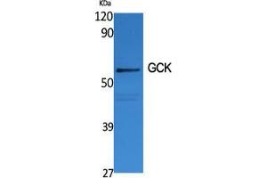 Western Blot (WB) analysis of specific cells using GCK Polyclonal Antibody. (GCK 抗体  (N-Term))