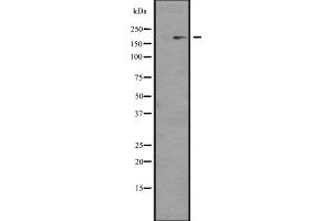 Western blot analysis of NCOA1 expression in KAT13A / SRC1 transfected 293 cell line lysate;,The lane on the left is treated with the antigen-specific peptide. (NCOA1 抗体)