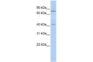 WB Suggested Anti-KLHL3 Antibody Titration:  0. (KLHL3 抗体  (Middle Region))