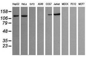 Image no. 2 for anti-Phosphoinositide-3-Kinase, Catalytic, gamma Polypeptide (PIK3CG) antibody (ABIN1500208)