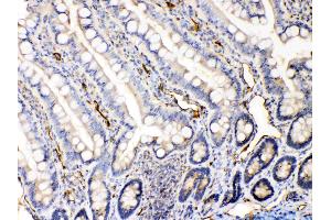 IHC analysis of Bax using anti-Bax antibody . (BAX 抗体  (N-Term))