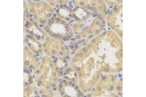 Immunohistochemistry of paraffin-embedded human kidney using SMYD5 antibody (ABIN6129324, ABIN6148173, ABIN6148174 and ABIN6221783). (SMYD5 抗体)