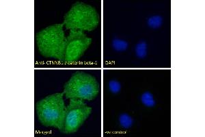ABIN2630016 Immunofluorescence analysis of paraformaldehyde fixed U2OS cells, permeabilized with 0. (CTNNB1 抗体  (AA 108-121))