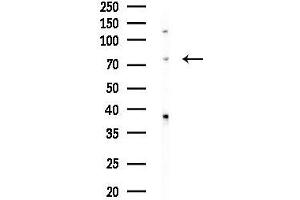 anti-Heat Shock 70kD Protein 12B (HSPA12B) (N-Term) antibody