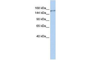 NBEAL1 antibody used at 1 ug/ml to detect target protein. (NBEAL1 抗体  (N-Term))