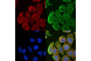 ABIN6261640 and ABIN6276821 staining Hela cells(30 min of UV treatment) by IF/ICC.