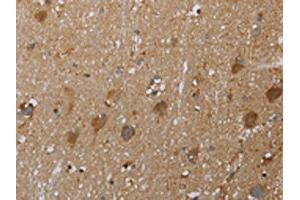 The image on the left is immunohistochemistry of paraffin-embedded Human brain tissue using ABIN7129016(COX6B2 Antibody) at dilution 1/50, on the right is treated with fusion protein. (COX6B2 抗体)