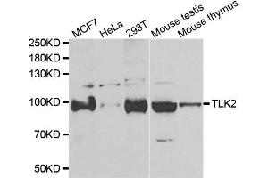 Western blot analysis of extracts of various cell lines, using TLK2 antibody. (TLK2 抗体)