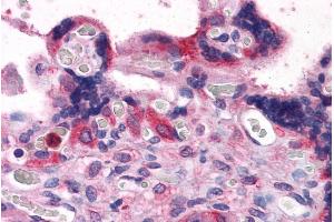 Immunohistochemistry (IHC) image for anti-BCL2-Associated Athanogene 3 (BAG3) (C-Term) antibody (ABIN184770)