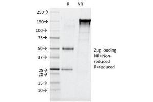 SDS-PAGE Analysis of Purified, BSA-Free Elastase 3B Antibody (clone CELA3B/1257). (Elastase 3B 抗体  (AA 82-238))