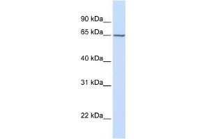 GALNAC4S-6ST antibody used at 1 ug/ml to detect target protein. (CHST15 抗体  (Middle Region))