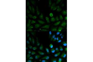 Immunofluorescence analysis of HepG2 cell using CAPZA2 antibody. (CAPZA2 抗体  (AA 1-286))