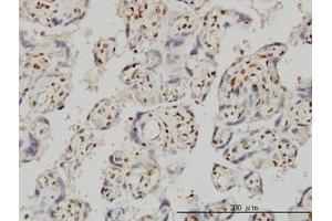 Image no. 1 for anti-Forkhead Box R2 (FOXR2) (AA 1-312) antibody (ABIN599326) (FOXR2 抗体  (AA 1-312))