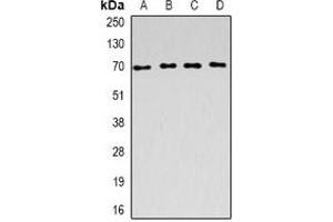 Western blot analysis of ACADVL expression in SW620 (A), Raji (B), mouse kidney (C), rat liver (D) whole cell lysates. (ACADVL 抗体)