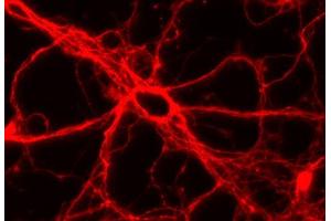 Immunocytochemistry (ICC) image for anti-tau Protein (AA 3-214) antibody (ABIN1742569) (tau 抗体  (AA 3-214))